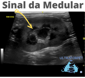 O que significa o Sinal da Medular na ultrassonografia veterinária?