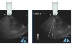 Ultrassonografia pulmonar na medicina veterinária