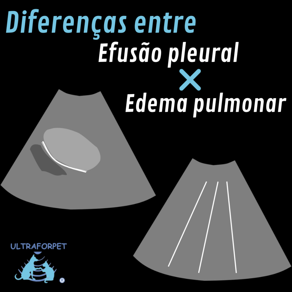 Diferenças ultrassonográficas de efusão pleural e edema pulmonar